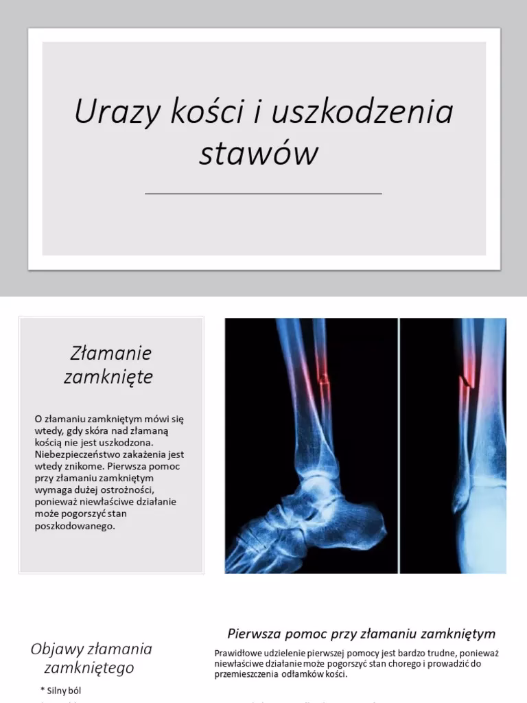 Jakie objawy towarzyszą złamaniu?